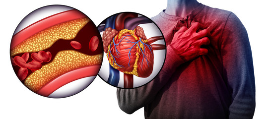 Herz in Fett aus Cholesterin